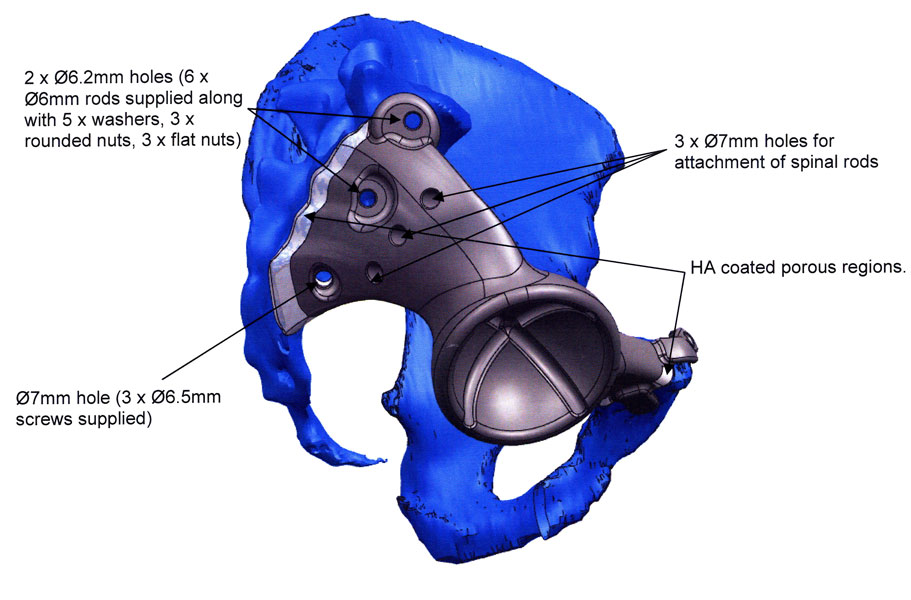 Fig 6. Technical drawing lateral